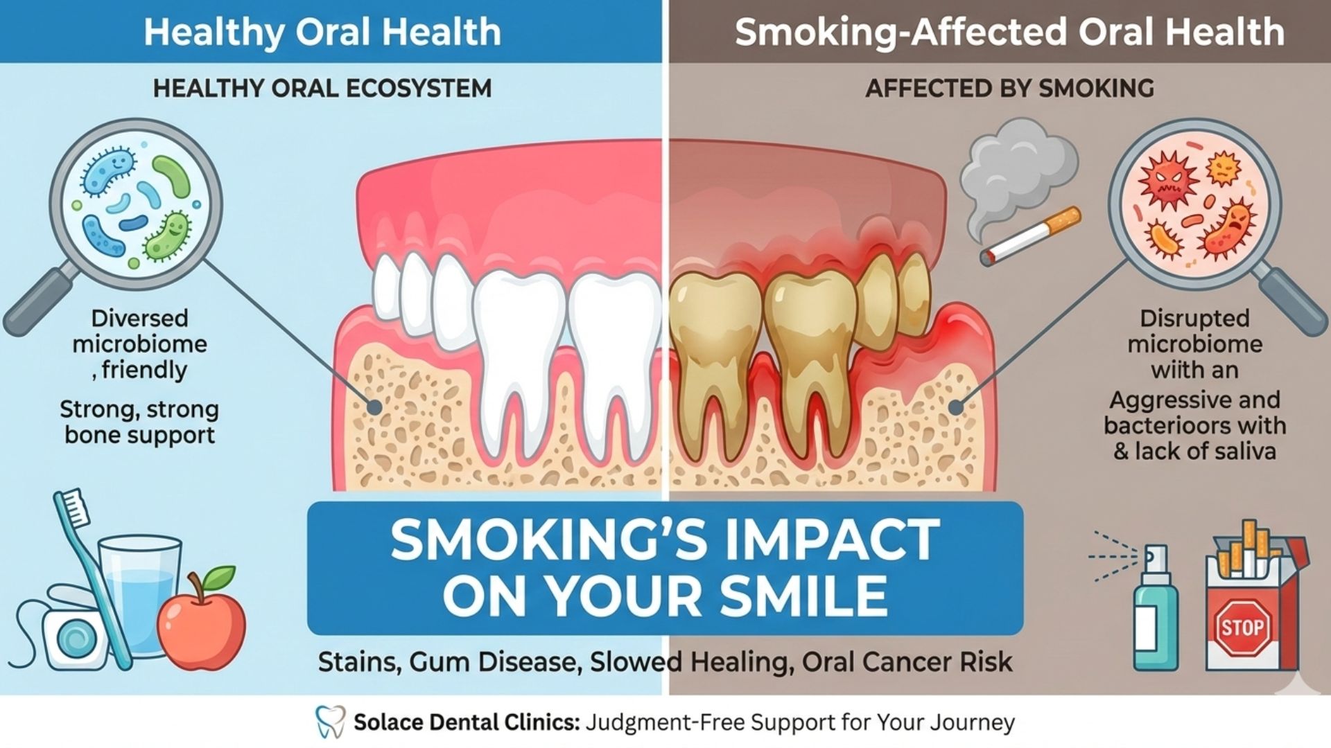 How can smoking affect my oral health? - Solace Dental Clinics, Igbogbo ...