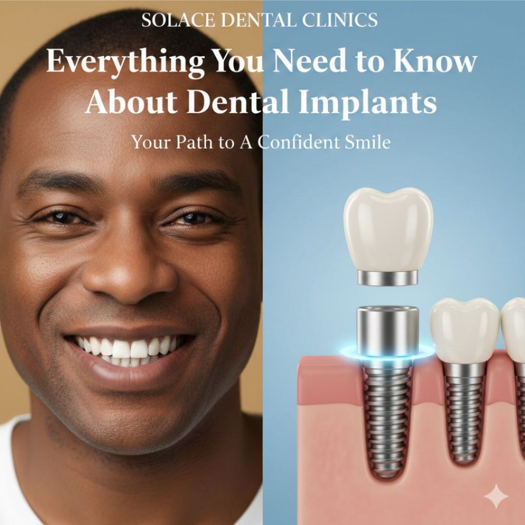 Dental implants from Solace Dental CLinics